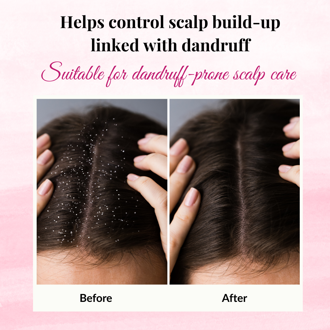 Phillauri Red Onion Black Seed Shampoo For Hair Growth, 750ml