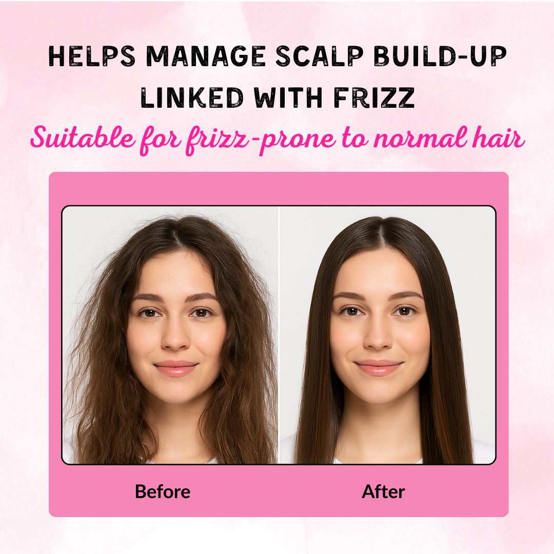 Phillauri Red Onion Black Seed Conditioner For Hair Growth, 100ML