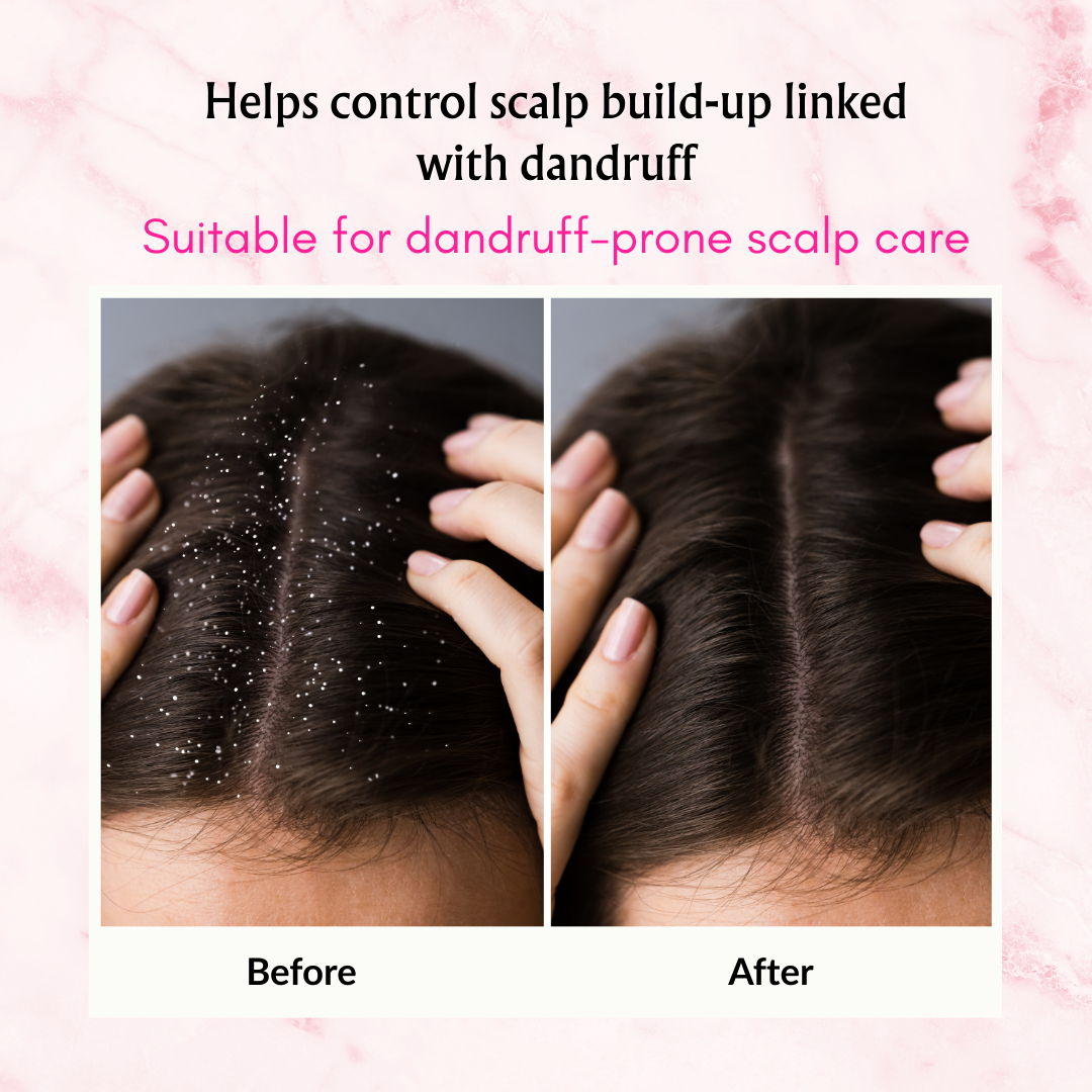 Phillauri Red Onion Black Seed Shampoo, Hair Oil, Conditioner For Hair Care