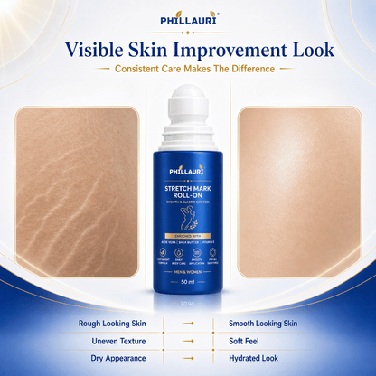 Phillauri Stretch Mark Roll-On
