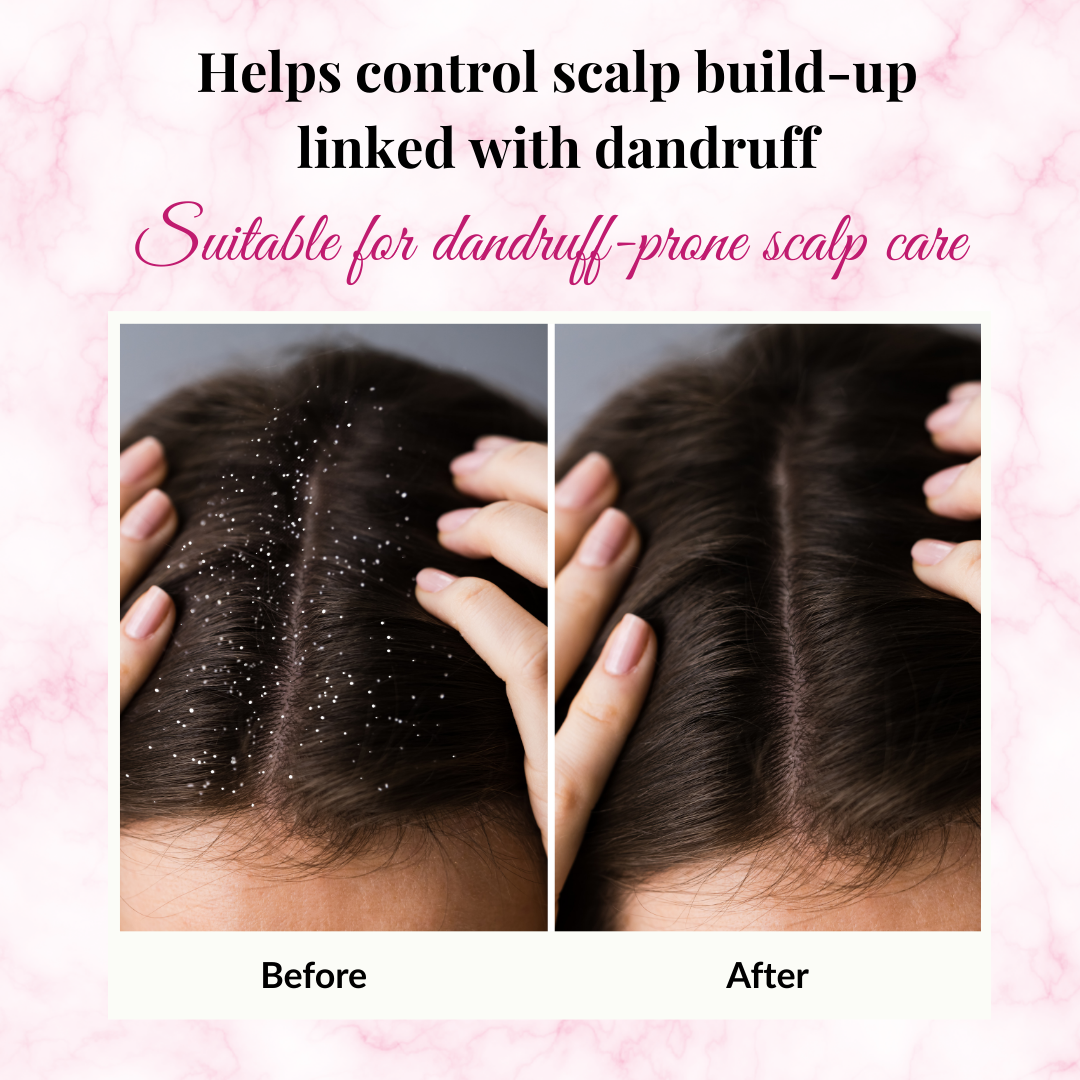 Phillauri Red Onion Black Seed Shampoo For Hair Regrowth, 300ML