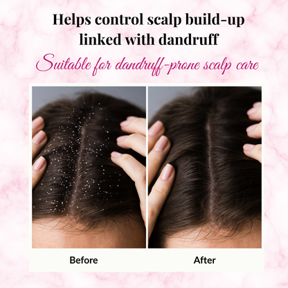 Phillauri Red Onion Black Seed Shampoo For Hair Regrowth, 300ML